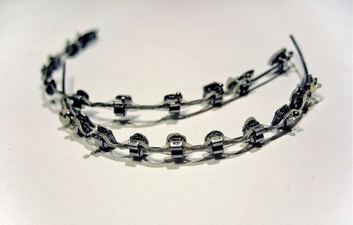 1200px-Dental-braces