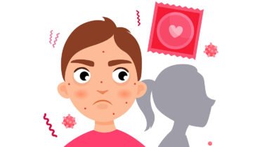 Do I Have Syphilis?